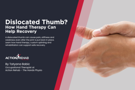 Hand therapy treatment for a dislocated thumb at Action Rehab - The Hands Physio, demonstrating rehabilitation and joint support techniques.